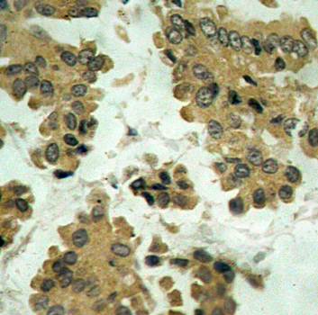 Akt2 (Ab-474) Antibody