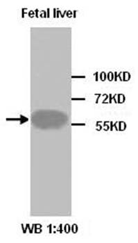 AKT2 Rabbit Polyclonal Antibody