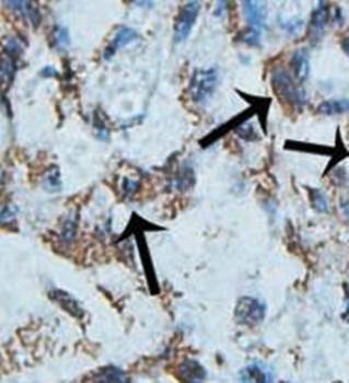 AKT2 Rabbit Polyclonal Antibody