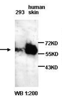 AKT2 Rabbit Polyclonal Antibody