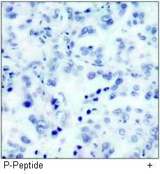 Akt2 (Phospho-Ser474) Antibody