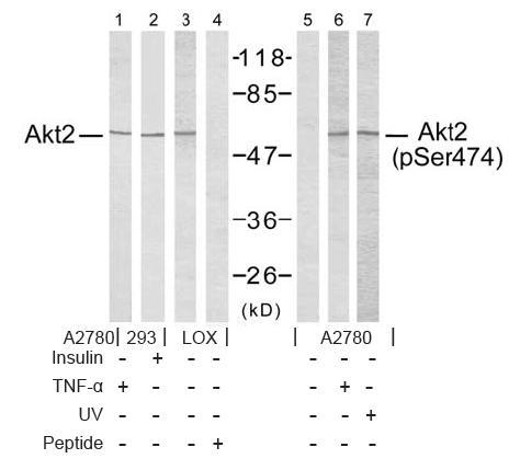 Akt2 (Phospho-Ser474) Antibody