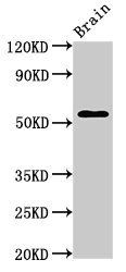 AKT3 Antibody