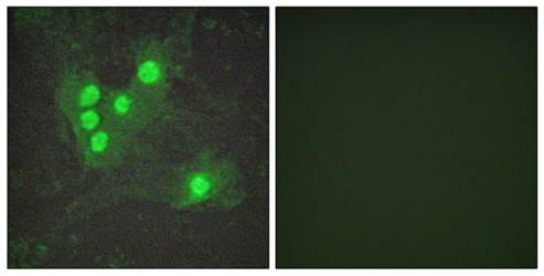 Akt (Phospho-Ser473) Antibody