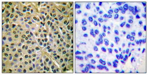 Akt (Phospho-Ser473) Antibody