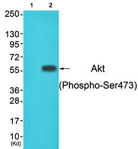 Akt (Phospho-Ser473) Antibody