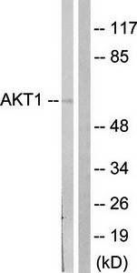 Akt (Ab-124) Antibody