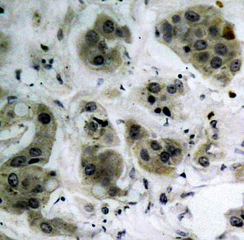 Akt (Ab-473) Antibody