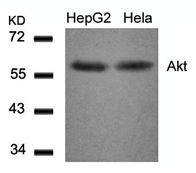 Akt (Ab-308) Antibody