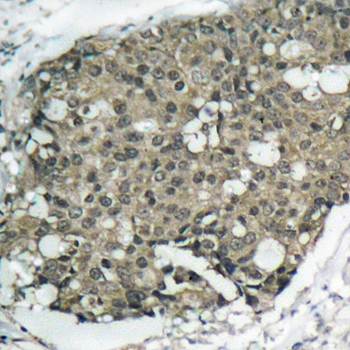 Akt (Ab-308) Antibody