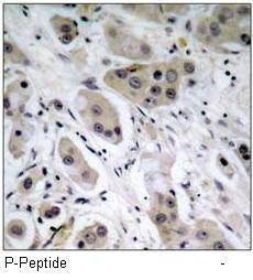 Akt (Phospho-Ser473) Antibody