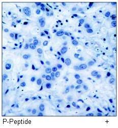 Akt (Phospho-Ser473) Antibody