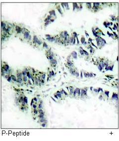 Akt (Phospho-Thr308) Antibody