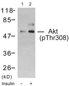 Akt (Phospho-Thr308) Antibody