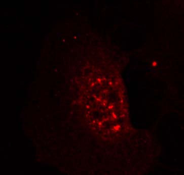 Akt (Phospho-Thr308) Antibody