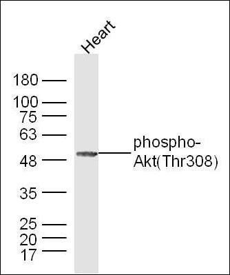 AKT (phospho-Thr308) antibody