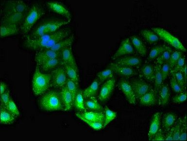 Alanine aminotransferase 1 antibody