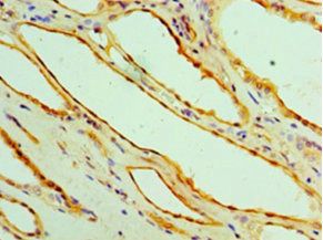 Alanine aminotransferase 1 antibody