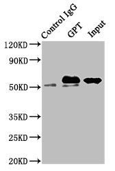 Alanine aminotransferase 1 antibody