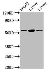 Alanine aminotransferase 1 antibody