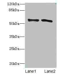 Alanine aminotransferase 1 antibody