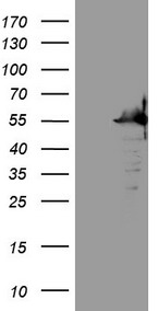 ALAS1 Antibody
