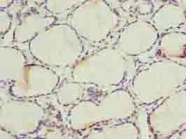 ALAS2 Antibody