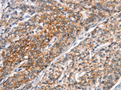 ALCAM Antibody