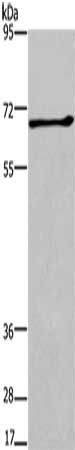 ALCAM Antibody