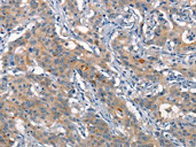 ALCAM Antibody