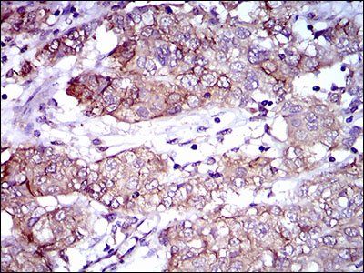 ALCAM Antibody