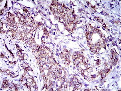 ALCAM Antibody