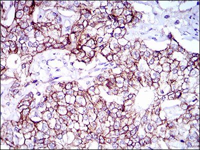 ALCAM Antibody