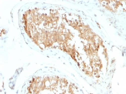 ALDH1A1 (Aldehyde Dehydrogenase 1A1) Antibody