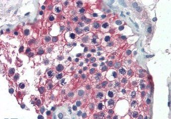 Goat anti-ALDH1A1 (Internal) Antibody