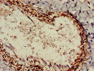 ALDH1A2 Antibody
