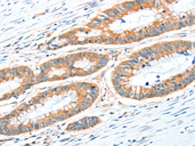 ALDH1A2 Antibody