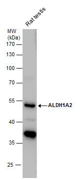 ALDH1A2 antibody