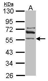 ALDH1A2 antibody