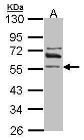 ALDH1A2 antibody [C1C3]