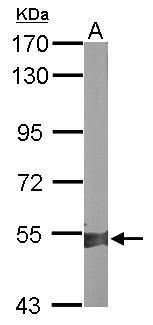 ALDH1A2 antibody