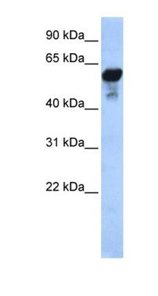 ALDH1B1 antibody