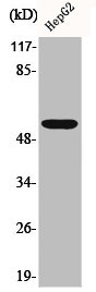 ALDH1B1 Antibody
