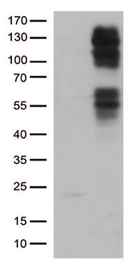 ALDH1L1 Antibody