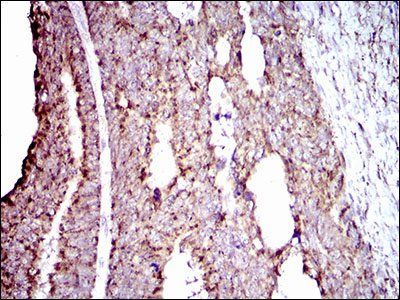 ALDH2 Antibody