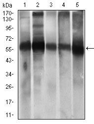 ALDH2 Antibody