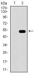 ALDH2 Antibody