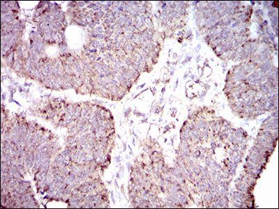 ALDH2 Antibody