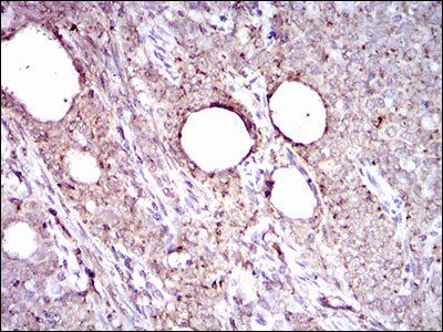 ALDH2 Antibody