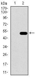 ALDH2 Antibody